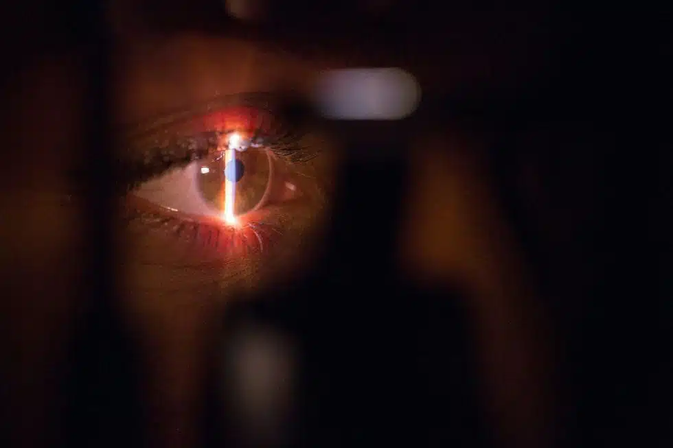 øjenlaseroperation